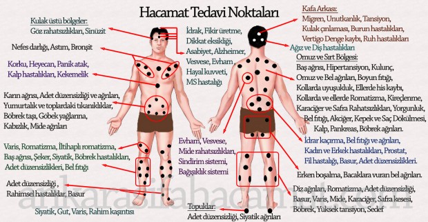 Hacamat Noktaları