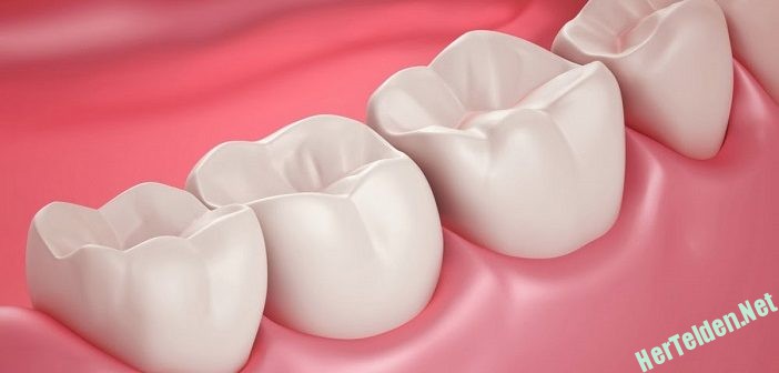 DİŞ ÇÜRÜKLERİ DİŞ ÇÜRÜKLERİ