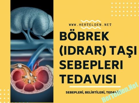 Böbrek Taşı