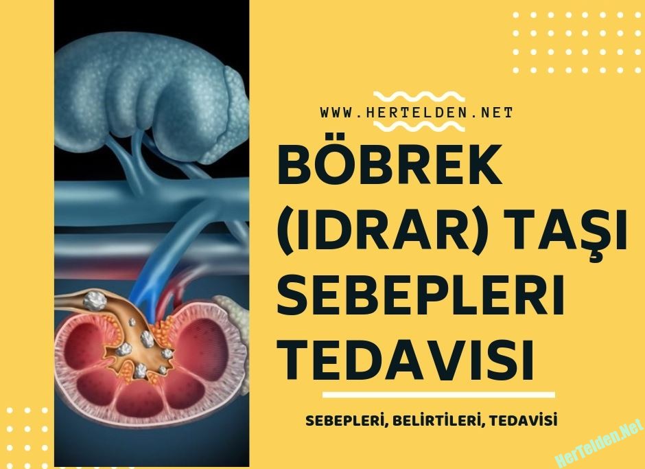 Böbrek – İdrar Taşları Böbrek Taşı
