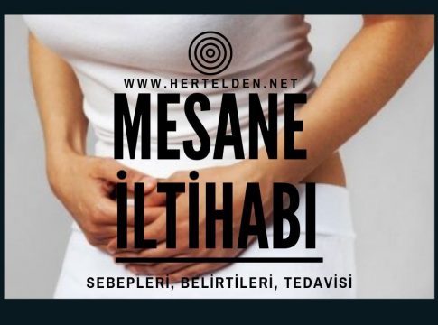 Mesane İltihabı