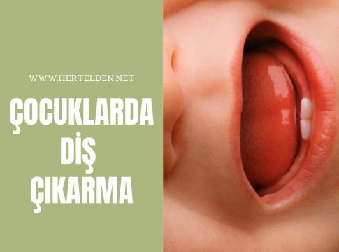 Çocuklarda Diş Çıkarma