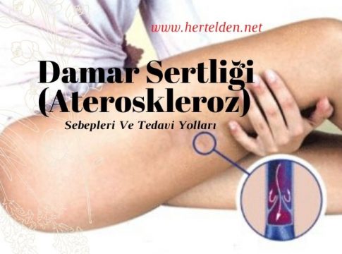 damar sertliği