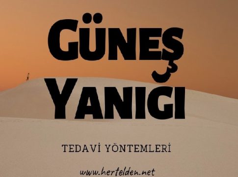 Güneş Yanığı