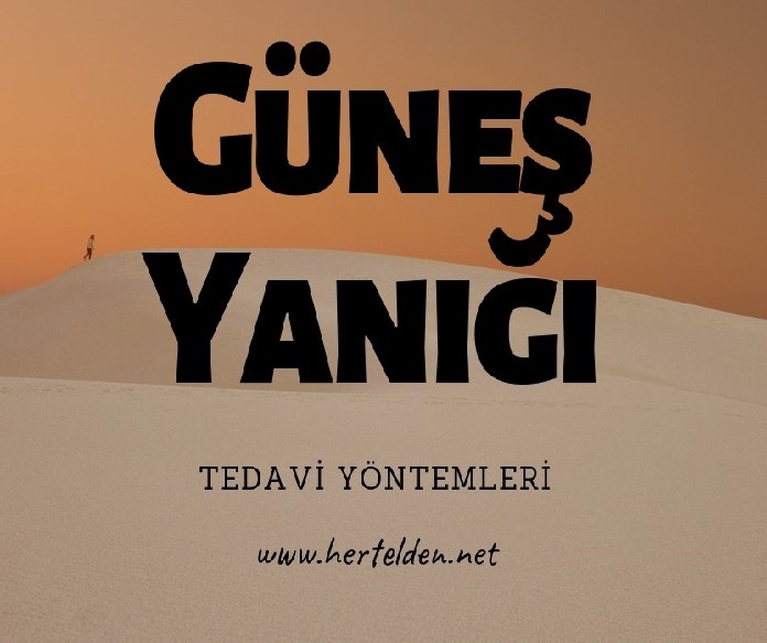 Güneş Yanığı Güneş Yanığı