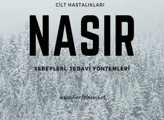 Nasır Neden Olur? Nasır Tedavisi Nasıldır? Nasır
