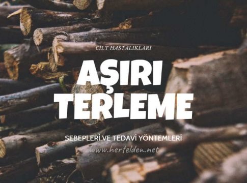 Aşırı terleme