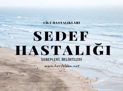 sedef - psoriasis hastalığı