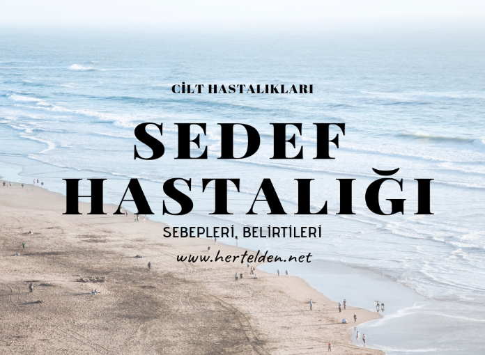 Sedef – psoriasis hastalığı Belirtileri, Nedenleri sedef - psoriasis hastalığı