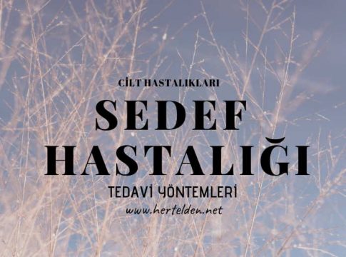 sedef hastalığı