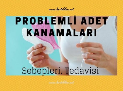 Problemli Adet Kanamaları