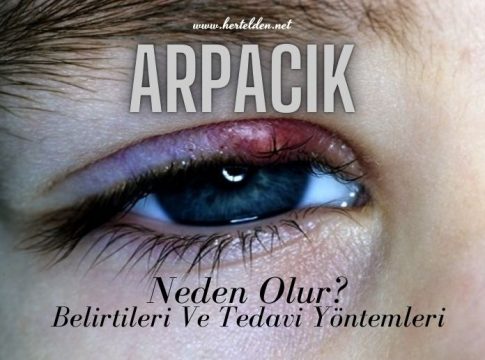 Gözde Arpacık