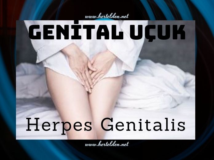 Genital Uçuk (Herpes Genitalis) Genital Uçuk (Herpes Genitalis)