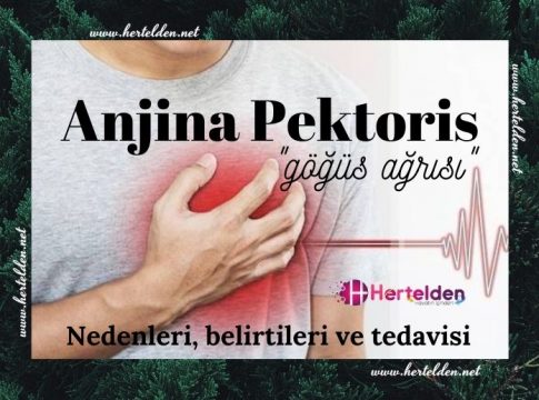 anjina pektoris