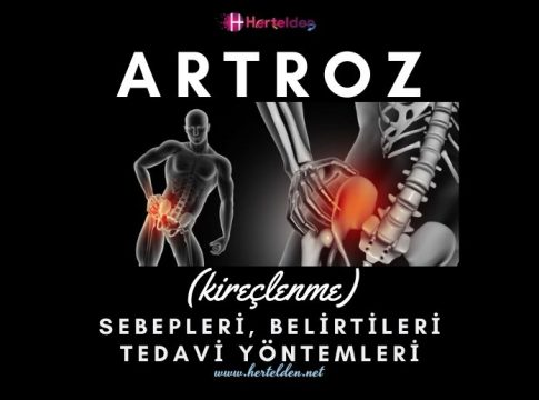 Artroz Nedir ? | Hertelden.Net