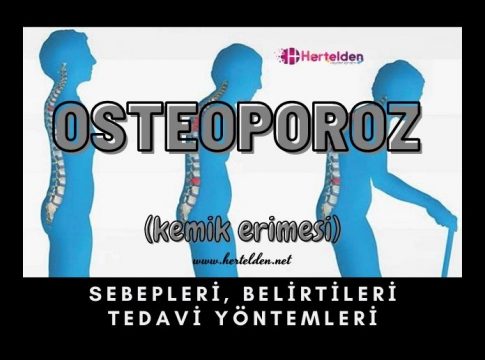 Osteoporoz Nedir? | Hertelden.Net
