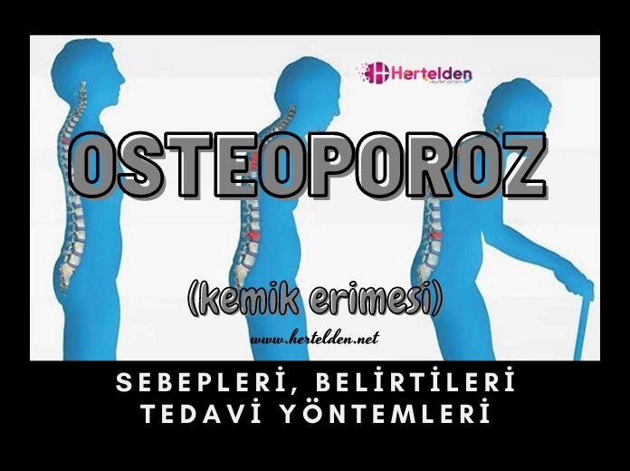 Kemik Erimesi (osteoporoz nedir?) Osteoporoz Nedir? | Hertelden.Net