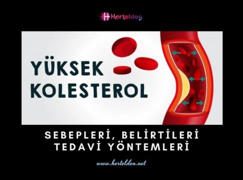Yüksek Kolesterol Belirtileri | Hertelden.Net