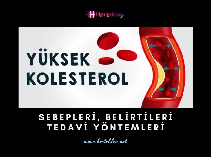 Yüksek Kolesterol Belirtileri, Nedenleri, Tedavisi Yüksek Kolesterol Belirtileri | Hertelden.Net