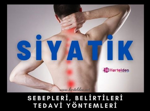 Siyatik Şikayetleri