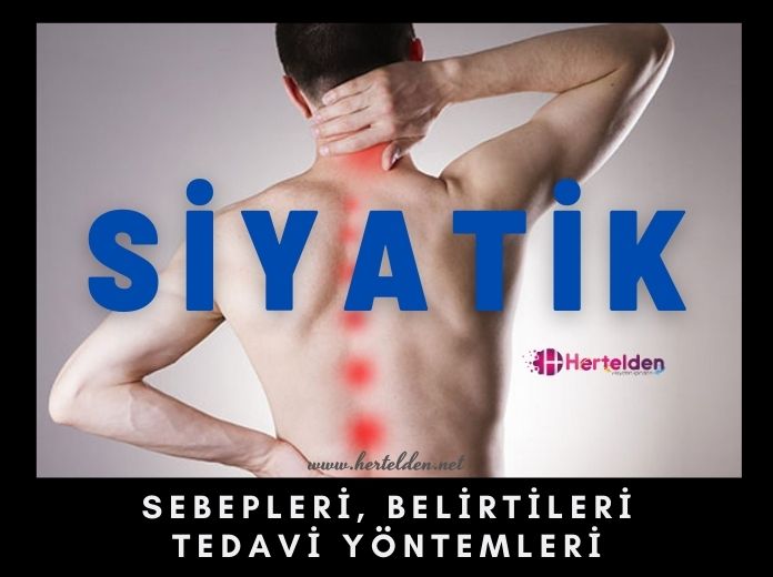 Siyatik Şikayetleri Sebepleri ve Tedavisi Siyatik Şikayetleri